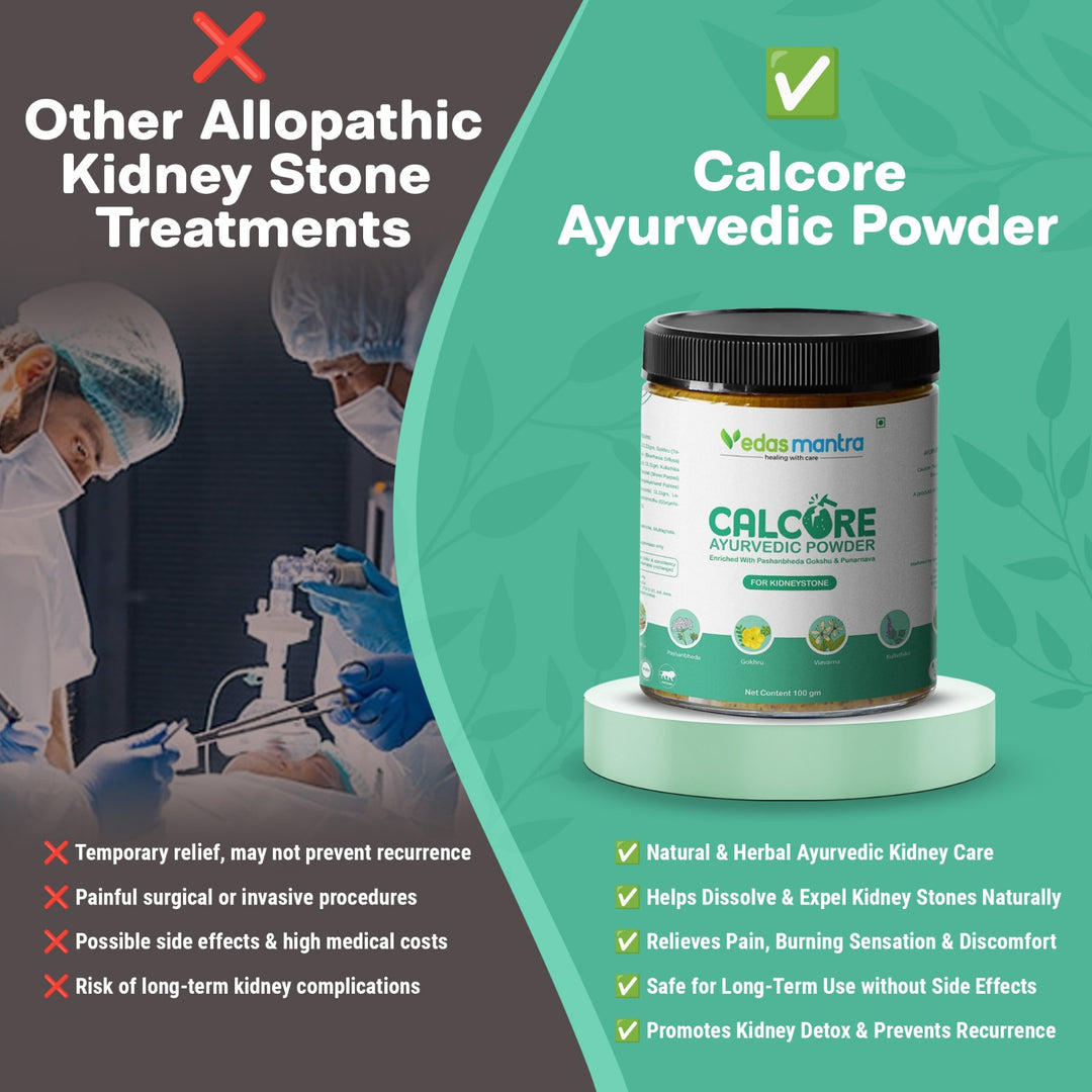 Calcore Powder For Quick Stone Dissolution (Free Consultation + Free diet Plan)